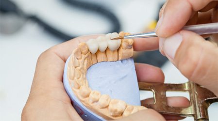 a dental laboratory technician crafting a crown